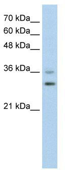 WB Suggested Anti-FOXQ1 Antibody Titration: 0.2-1 ug/ml; Positive Control: HepG2 cell lysate