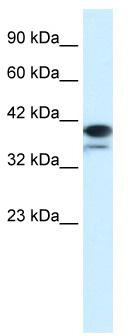 WB Suggested Anti-PARP6 Antibody Titration: 1.25 ug/ml; Positive Control: Daudi cell lysatePARP6 is supported by BioGPS gene expression data to be expressed in Daudi