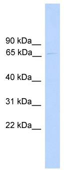 WB Suggested Anti-PARP6 Antibody Titration: 0.2-1 ug/ml; ELISA Titer: 1:12500; Positive Control: 721_B cell lysate