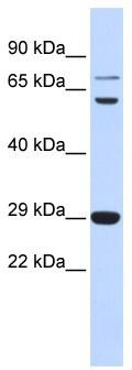 WB Suggested Anti-CD40LG Antibody Titration: 0.2-1 ug/ml; ELISA Titer: 1:312500; Positive Control: Human Muscle
