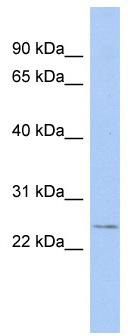 WB Suggested Anti-EVI2A Antibody Titration: 0.2-1 ug/ml; ELISA Titer: 1:62500; Positive Control: ACHN cell lysateEVI2A is supported by BioGPS gene expression data to be expressed in ACHN