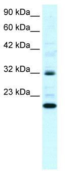 WB Suggested Anti-ARHGDIG Antibody Titration: 0.2-1 ug/ml; Positive Control: Daudi cell lysate
