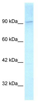 WB Suggested Anti-KIF1C Antibody Titration: 2.5 ug/ml; Positive Control: Hela cell lysate