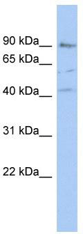 WB Suggested Anti-PARP12 Antibody Titration: 0.2-1 ug/ml; ELISA Titer: 1:62500; Positive Control: ACHN cell lysatePARP12 is supported by BioGPS gene expression data to be expressed in ACHN
