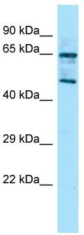 Host: Rabbit; Target Name: Rgs14; Sample Tissue: Mouse Stomach lysates; Antibody Dilution: 1.0 ug/ml