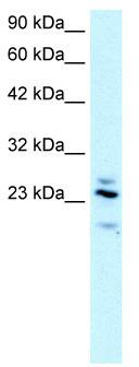 WB Suggested Anti-RGS20 Antibody Titration: 2.5 ug/ml; Positive Control: Human brain