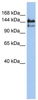 WB Suggested Anti-SUPT5H Antibody Titration: 0.2-1 ug/ml; ELISA Titer: 1:1562500; Positive Control: Jurkat cell lysate