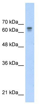WB Suggested Anti-PARP6 Antibody Titration: 0.2-1 ug/ml; Positive Control: HepG2 cell lysate