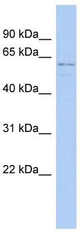 Gel: 12%SDS-PAGE<br>Lysate: 40 μg<br>Lane: Rat liver tissue lysate<br>Primary antibody: TA365292 (SELENOF Antibody) at dilution 1/1000<br>Secondary antibody: Goat anti rabbit IgG at 1/5000 dilution<br>Exposure time: 1 minute