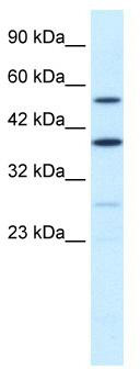 WB Suggested Anti-DXYS155E Antibody Titration: 0.2-1 ug/ml; ELISA Titer: 1:312500; Positive Control: Jurkat cell lysate