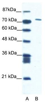 WB Suggested Anti-CXORF6 Antibody Titration: 1.25 ug/ml; ELISA Titer: 1:1562500; Positive Control: Jurkat cell lysate