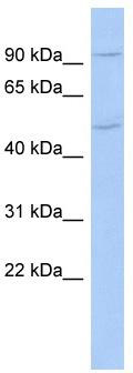 WB Suggested Anti-CXorf6 Antibody Titration: 0.2-1 ug/ml; ELISA Titer: 1:62500; Positive Control: COLO205 cell lysate