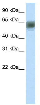WB Suggested Anti-ARID3B Antibody Titration: 1.25 ug/ml; ELISA Titer: 1:62500; Positive Control: Human Thymus