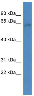 WB Suggested Anti-ARID3B Antibody Titration: 0.2-1 ug/ml; ELISA Titer: 1:12500; Positive Control: HepG2 cell lysate; ARID3B is supported by BioGPS gene expression data to be expressed in HepG2