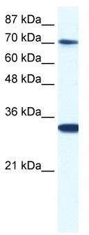 WB Suggested Anti-CNOT3 Antibody Titration: 0.2-1 ug/ml; ELISA Titer: 1:1562500; Positive Control: Jurkat cell lysate; CNOT3 is strongly supported by BioGPS gene expression data to be expressed in Human Jurkat cells