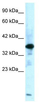 WB Suggested Anti-ZFPL1 Antibody Titration: 0.2-1 ug/ml; Positive Control: Human Muscle
