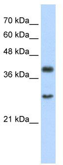 WB Suggested Anti-WDR39 Antibody Titration: 2.5 ug/ml; Positive Control: Jurkat cell lysate. CIAO1 is supported by BioGPS gene expression data to be expressed in Jurkat