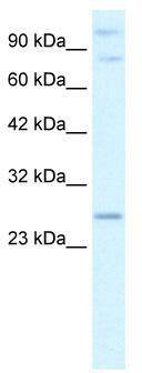 WB Suggested Anti-PCGF3 Antibody Titration: 2.5 ug/ml; ELISA Titer: 1:62500; Positive Control: Human brain