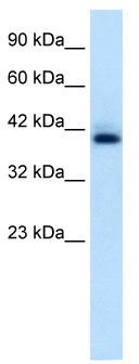 WB Suggested Anti-HEXIM1 Antibody Titration: 0.6 ug/ml; ELISA Titer: 1:12500; Positive Control: Jurkat cell lysate