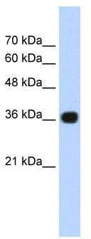 Gel: 8%SDS-PAGE<br>Lysate: 40 μg<br>Lane 1-4: HepG2<br>293T and Hela cell<br>Human fetal liver tissue lysates<br>Primary antibody: TA366210 (ECH1 Antibody) at dilution 1/300<br>Secondary antibody: Goat anti rabbit IgG at 1/8000 dilution<br>Exposure time: 15 seconds