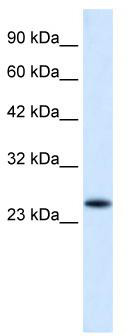WB Suggested Anti-VPS24 Antibody Titration: 0.2-1 ug/ml; ELISA Titer: 1:12500; Positive Control: HepG2 cell lysate