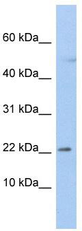 WB Suggested Anti-C19orf25 Antibody Titration: 0.2-1 ug/ml; ELISA Titer: 1:312500; Positive Control: OVCAR-3 cell lysate