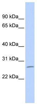 WB Suggested Anti-ZNF575 Antibody Titration: 0.2-1 ug/ml; ELISA Titer: 1:62500; Positive Control: MCF7 cell lysate