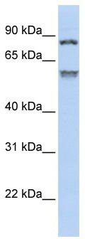 WB Suggested Anti-TRIM50 Antibody Titration: 0.2-1 ug/ml; ELISA Titer: 1:312500; Positive Control: Jurkat cell lysate