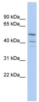 WB Suggested Anti-TRIM50 Antibody Titration: 0.2-1 ug/ml; ELISA Titer: 1:312500; Positive Control: COLO205 cell lysate