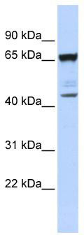 WB Suggested Anti-SCML4 Antibody Titration: 0.2-1 ug/ml; ELISA Titer: 1:1562500; Positive Control: OVCAR-3 cell lysate