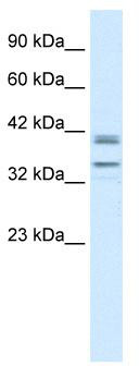 WB Suggested Anti-ONECUT3 Antibody Titration: 0.2-1 ug/ml; ELISA Titer: 1:12500; Positive Control: Jurkat cell lysate