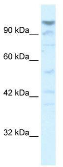 WB Suggested Anti-LARP2 Antibody Titration: 5.0 ug/ml; ELISA Titer: 1:62500; Positive Control: HepG2 cell lysate. LARP1 is strongly supported by BioGPS gene expression data to be expressed in Human HepG2 cells