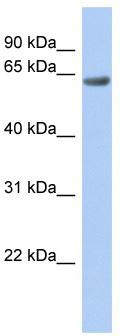 WB Suggested Anti-TBC1D10B Antibody Titration: 0.2-1 ug/ml; ELISA Titer: 1:62500; Positive Control: Human Stomach