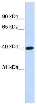 WB Suggested Anti-TFB1M Antibody Titration: 0.2-1 ug/ml; ELISA Titer: 1:312500; Positive Control: Human Liver