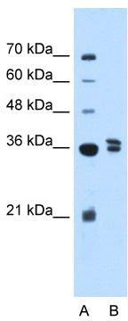 WB Suggested Anti-TFB1M Antibody Titration: 2.5 ug/ml; ELISA Titer: 1:312500; Positive Control: 721_B cell lysateTFB1M is supported by BioGPS gene expression data to be expressed in 721_B