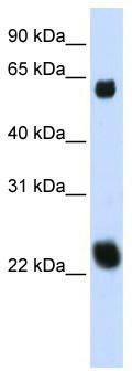 WB Suggested Anti-KLHL26 Antibody Titration: 0.2-1 ug/ml; ELISA Titer: 1:312500; Positive Control: 293T cell lysateKLHL26 is supported by BioGPS gene expression data to be expressed in HEK293T