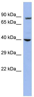 WB Suggested Anti-WDR45L Antibody Titration: 0.2-1 ug/ml; ELISA Titer: 1:312500; Positive Control: OVCAR-3 cell lysate WDR45B is supported by BioGPS gene expression data to be expressed in OVCAR3