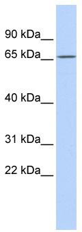 WB Suggested Anti-PRDM8 Antibody Titration: 0.2-1 ug/ml; ELISA Titer: 1:312500; Positive Control: MCF7 cell lysate