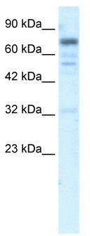 WB Suggested Anti-RIN3 Antibody Titration: 5.0 ug/ml; ELISA Titer: 1:62500; Positive Control: HepG2 cell lysateThere is BioGPS gene expression data showing that RIN3 is expressed in HepG2