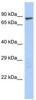 WB Suggested Anti-LAS1L Antibody Titration: 0.2-1 ug/ml; Positive Control: HepG2 cell lysate