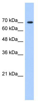 WB Suggested Anti-LAS1L Antibody; Titration: 1.25 ug/ml; Positive Control: HepG2 Whole Cell