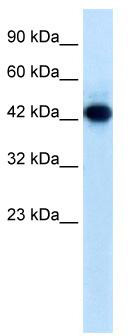 WB Suggested Anti-RNF135 Antibody Titration: 0.2-1 ug/ml; ELISA Titer: 1:62500; Positive Control: Jurkat cell lysate