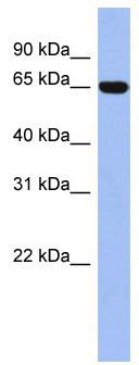 WB Suggested Anti-TRIM47 Antibody Titration: 0.2-1 ug/ml; ELISA Titer: 1:312500; Positive Control: THP-1 cell lysate