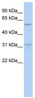 WB Suggested Anti-BTBD14B Antibody Titration: 0.2-1 ug/ml; ELISA Titer: 1:62500; Positive Control: 721_B cell lysate