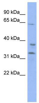 WB Suggested Anti-KBTBD5 Antibody Titration: 0.2-1 ug/ml; ELISA Titer: 1:1562500; Positive Control: HT1080 cell lysate