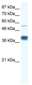 WB Suggested Anti-DKFZP781I1119 Antibody Titration: 0.125 ug/ml; ELISA Titer: 1:62500; Positive Control: HepG2 cell lysate