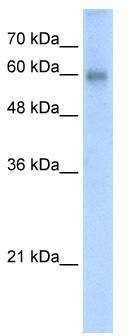 WB Suggested Anti-RCOR2 Antibody Titration: 5.0 ug/ml; Positive Control: Jurkat cell lysate