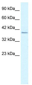 WB Suggested Anti-RIMS3 Antibody Titration: 1.25 ug/ml; ELISA Titer: 1:312500; Positive Control: Jurkat cell lysate RIMS3 is strongly supported by BioGPS gene expression data to be expressed in Human Jurkat cells