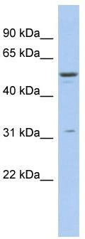 WB Suggested Anti-TRIM14 Antibody Titration: 0.2-1 ug/ml; ELISA Titer: 1:62500; Positive Control: THP-1 cell lysate