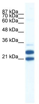WB Suggested Anti-TRIM34 Antibody Titration: 0.2-1 ug/ml; ELISA Titer: 1:62500; Positive Control: Jurkat cell lysate TRIM34 is supported by BioGPS gene expression data to be expressed in Jurkat